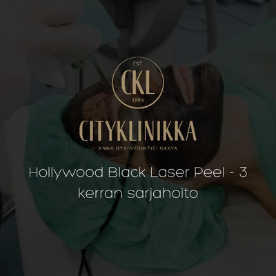 Hollywood Black Laser Peel - 3 kerran sarjahoito