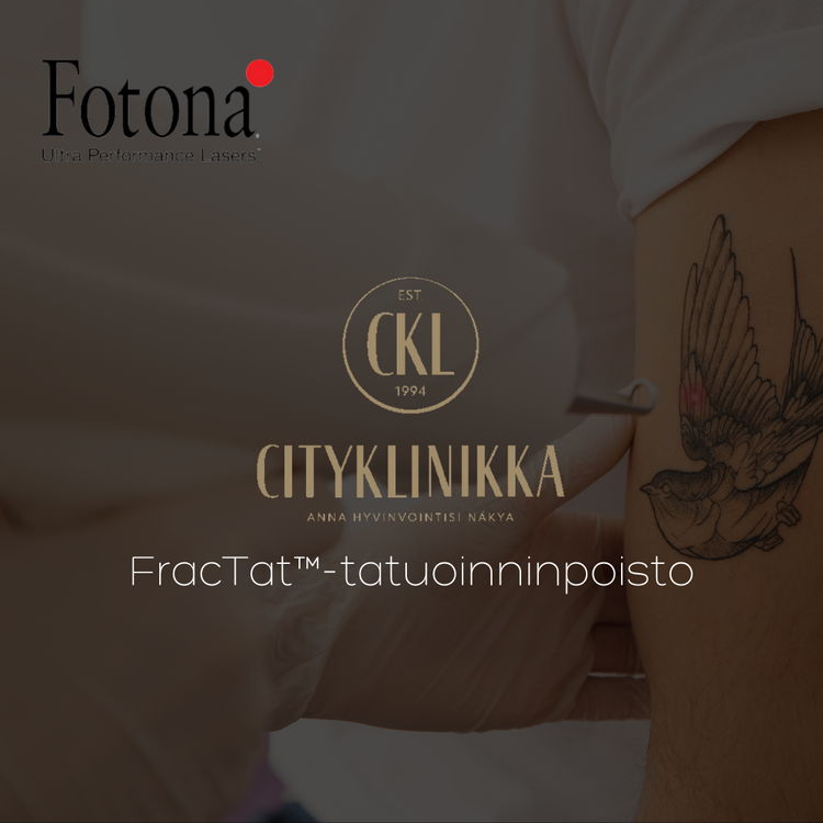 1KRT /  FracTat&trade;-tatuoinninpoisto